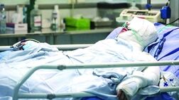 افزایش ۵۶ درصدی مرگ بر اثر سوختگی