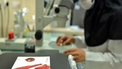 اجرای ۸ پروژه ملی جهت تامین داروهای زیستی برای درمان ناباروری بانوان