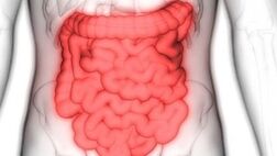 تغییرات لایه مخاطی روده عامل بروز کولیت روده